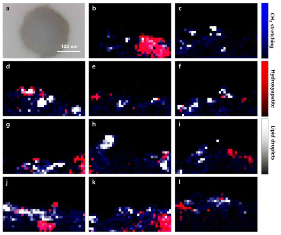 뼈세포(osteoblast)와 지방세포(adipocyte)가 혼합된 오가노이드 형성 및 라만 분포맵 분석 a 혼합 오가노이드 광학이미지. b 뼈세포만, c 지방세포만 존재하는 영역의 라만 분포맵. d-l 두 분화세포가 혼재된 영역의 라만 분포맵 (파랑색-세포 표면, 빨간색-골분화, 흰색-지방분화를 나타냄)