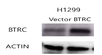 BTRC 단백질 발현 조사