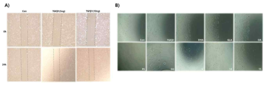 T-HESCs 세포주에서 TGF-β1에 의한 Wound healing assay 방법으로 후보소재들의 억제 효과