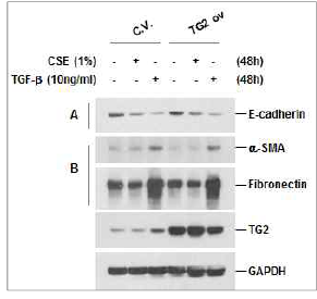 폐상피세포에서 [CSE 또는 transforming growth factor-β (TGF-β) 처치에 의한 epithelialmesenchymal transition (EMT) 유도]에 미치는 TG2 역할 평가