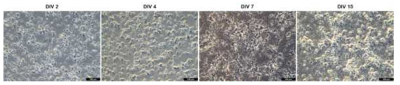 마우스 신경세포 초대배양법 확립. Day In Vitro (DIV) 2, 4, 7, 15에서 neurite와 axon 이 관찰되는 초대배양 신경세포 이미지