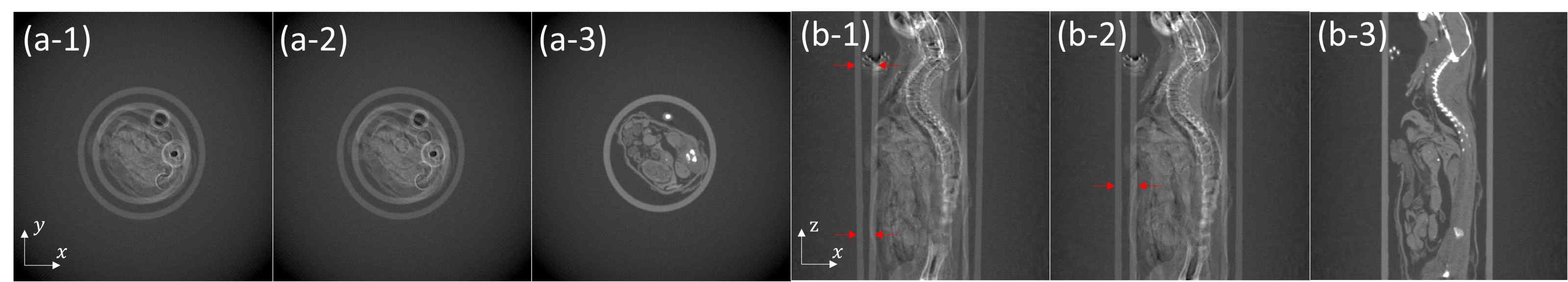 Micro-CT 시스템 오차 보정 전과 후를 나타내는 마우스 팬텀 테스트 영상: (a), (b)는 각각 axial 뷰와 sagittal 뷰로 (1), (2), (3)은 보정 전, η만 보정 후, η, u0, υ0보정 후를 나타냄