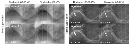 마우스 팬텀에 제안한 두 알고리즘 적용 결과로 뼈를 억제한 영상과 연조직을 억제한 영상 결과이며 단일조사에 경우 상/하부 사이에 0.1 mmCu를 추가함