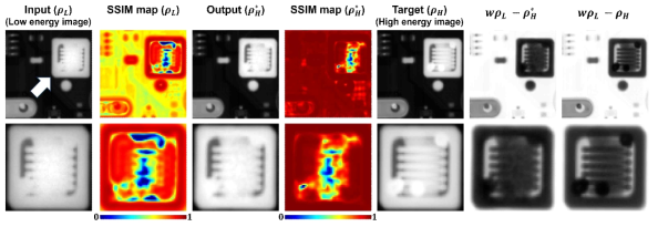 딥러닝 네트워크를 통해 획득한 높은 에너지 출력 영상과 이중에너지 재구성 영상 결과 및 SSIM 맵