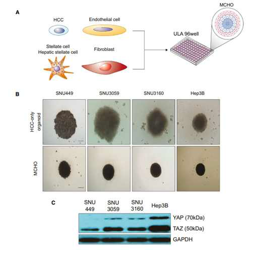 제작한 간암 다세포 오가노이드에서의 YAP/TAZ 발현정도 비교