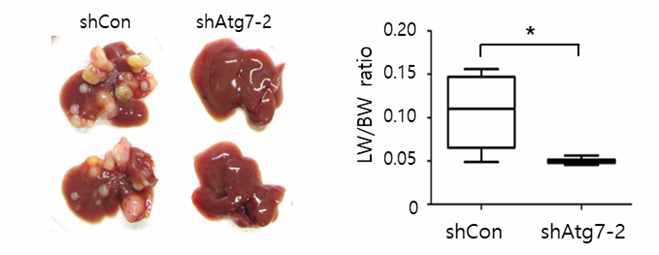 Hydrodynamic Transfection 기법을 통해 제작한 간암에서 ATG7을 표적치료 하였을 때 나타나는 항암 효과. 적출한 간에서 ATG7 녹다운에 의해 암 발생이 간에서 급격히 줄어듬을 확인함 (왼쪽 그림). 항암효과의 정량적비교를 위해 간의 상대적 무게를 비교함. ATG7 녹다운에 의해 암의 소멸로 인해 간의 무게가 줄어듦을 확인함