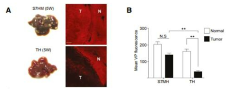 YAP/TAZ 가 활성화가 다른 두 간암 모델에서 형광물질 주입 후 간암으로의 침투 정도 비교. T는 tumor 부위, N은 정상 조직부위