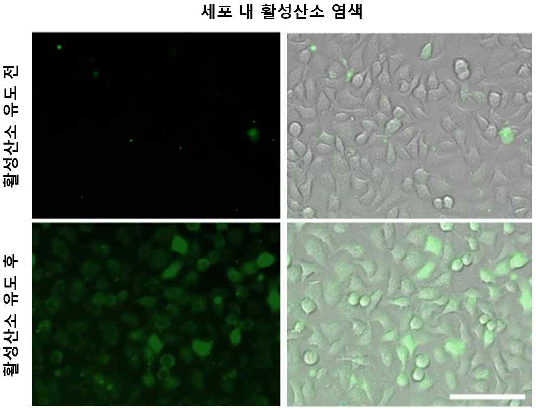 활성산소 유도 전/후 세포 내 활성산소 형광 염색