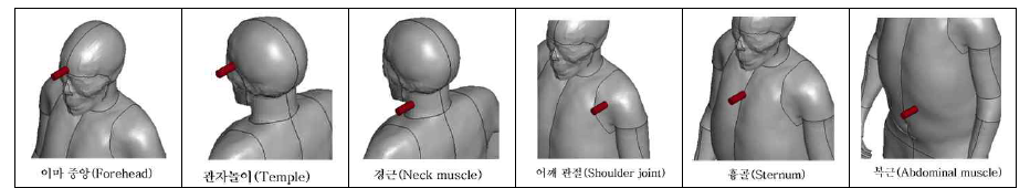 Forehead, Temple, Neck, Shoulder, Sternum and Abdomen