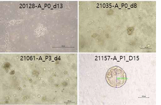 본 연구팀에서 수립한 복수 유래 오가노이드