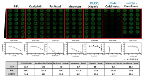 복수(22159-A)에서 수립된 오가노이드를 HTS 시스템에 적용하여 항암제 반응성을 확인함