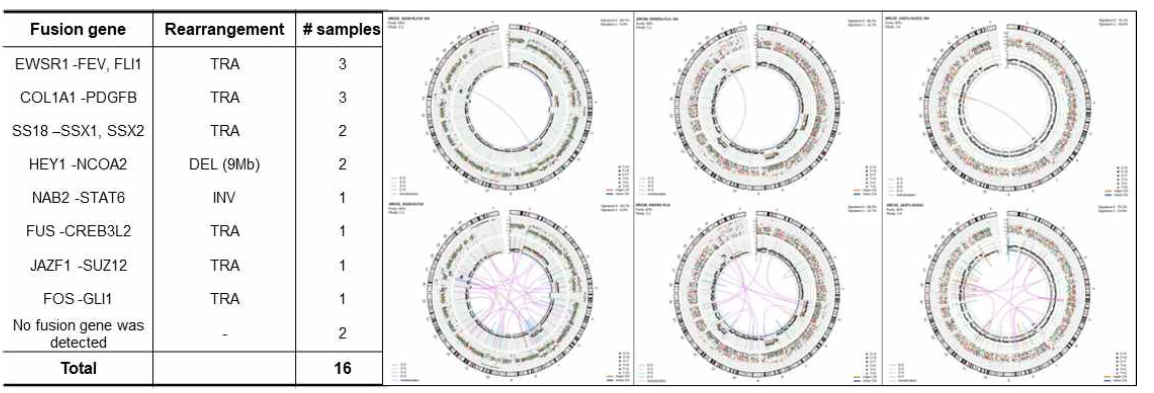 육종암 샘플의 유전체 분석결과 검출된 융합유전자 목록, 전장유전체 분석을 통한 유전체 변이현황 circos plot