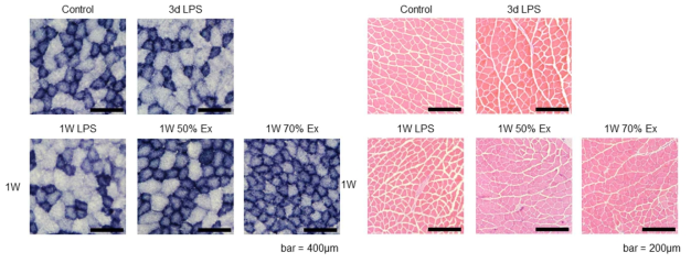 근육의 미토콘드리아 활성 염색 (좌, SDH staining), H&E staining (우)