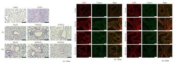 (좌) 폐 조직 H&E 염색, (우) SMA, Collagen I의 IHC 염색 - 폐 섬유화 진행 확인