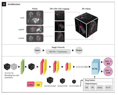 다중 파라미터 MRI 데이터를 이용한 BRCA 예측모델 개발 모식도