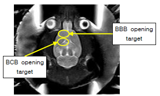 MRgFUS를 이용한 BBB opening과 BCB opening 위치 지정