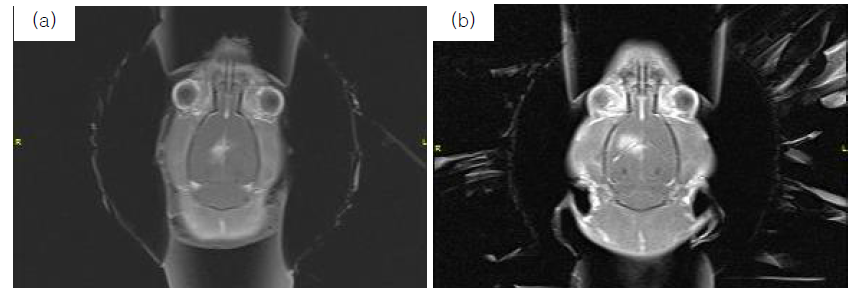 BCB opening at microbubble injection volume at (a) 35 μl and (b) 100 μl