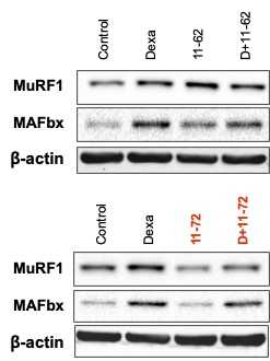 MuRF1과 MAFbx의 억제