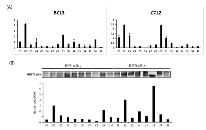 후보 바이오마커의 qPCR과 western blot 분석 (A) BCL3, CCL2 mRNA 발현. (B) METTL21C 단백질 발현