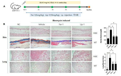 Bloemycin induced 전신경화증 동물모델에서 Ferroptosis inhibitor처리에 의한 치료효능 분석