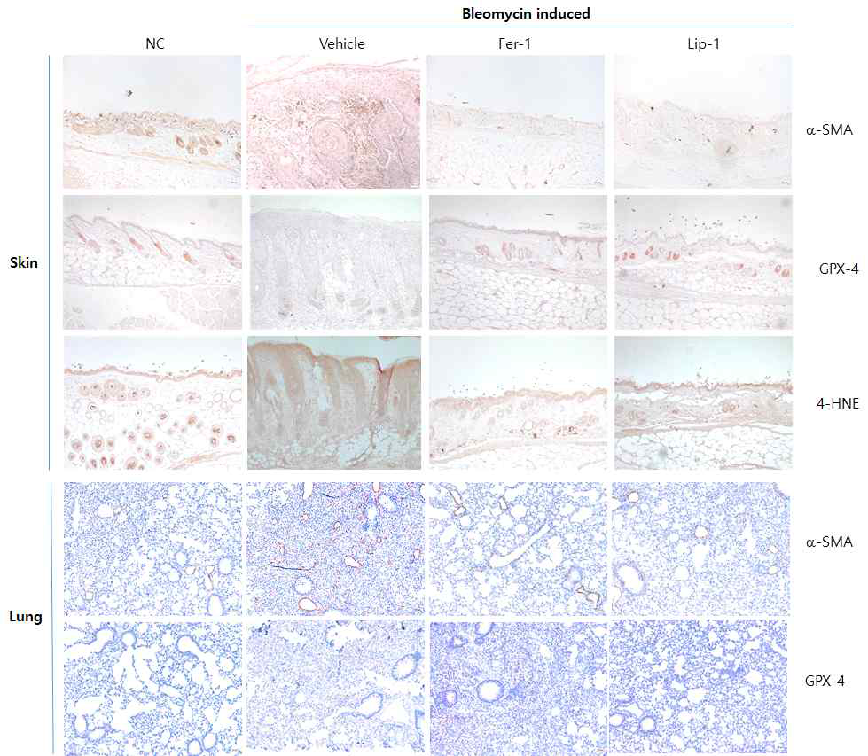 Boemycin induced 모델에서 Ferroptosis inhibitor처리에 의한 GPX-4발현 분석