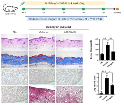 Bloemycin induced 전신경화증 동물모델에서 B.longum에 의한 항섬유화 효능