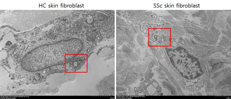 Skin fibroblast 전자현미경분석