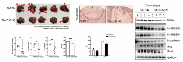 간세포 내 NOX2 결여 간암 마우스 유전자 변형 모델에서 간암 발생의 차이 결과