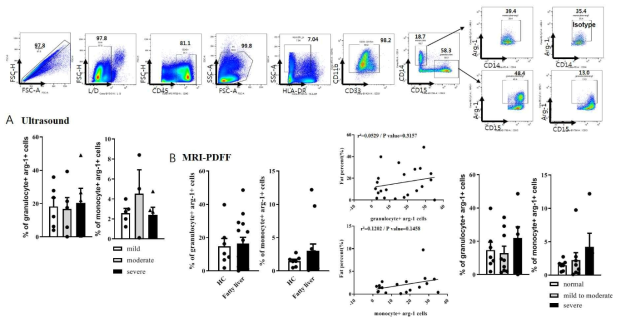 비알코올성 지방간이 동반된 환자에서 중증도에 따른 Arginase-1 발현 비교 및 발현 원인세포군 분석 결과