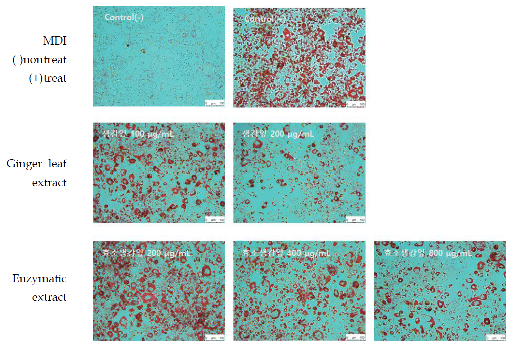 Oil Red O staining of 3T3-L1 adipocytes