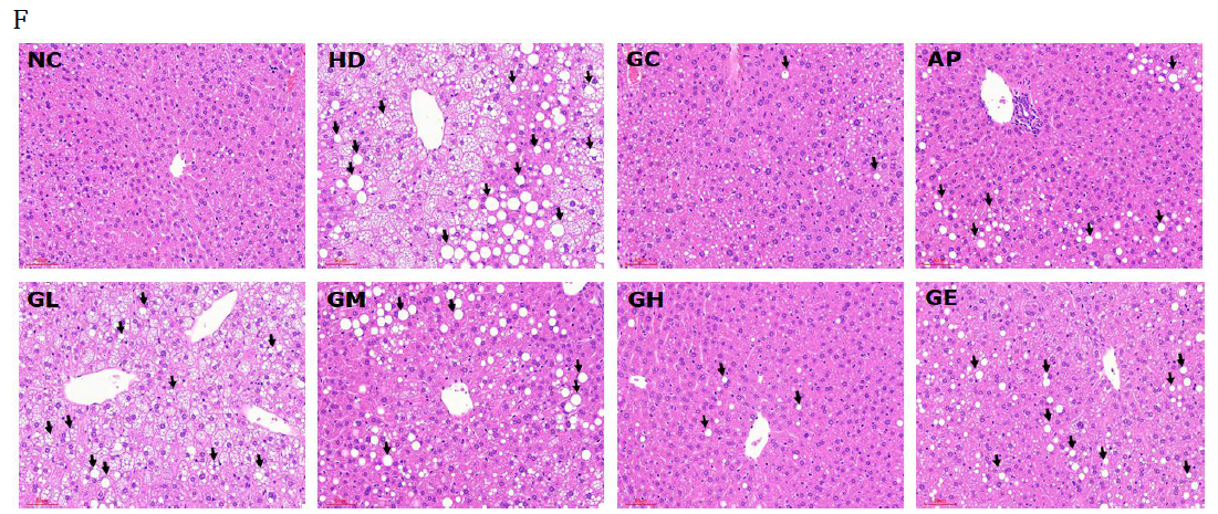 Effects of ginger leaf extract on hepatic steatosis in diet-induced obese mice Values are mean ± SD (n=8). a-e Means with different letters are significantly different (p<0.05) (Continued)