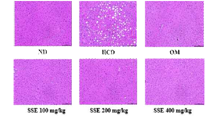 청가시덩굴 추출물을 투여한 고탄수화물식이 C57BL/6 마우스에서 간 조직의 조직병리학적 분석(100X)