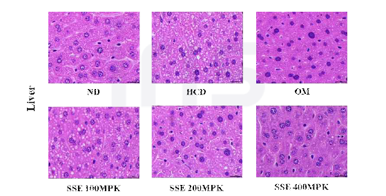청가시덩굴 추출물을 투여한 고탄수화물식이 C57BL/6 마우스에서 간 조직의 조직병리학적 분석(40X)