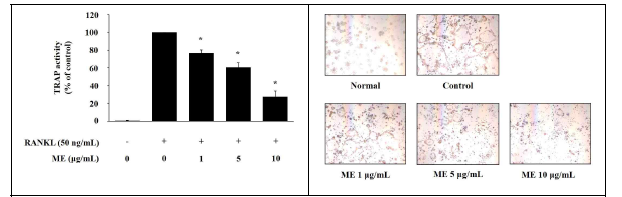 신이 추출물 (ME)의 TRAP activity와 TRAP staining
