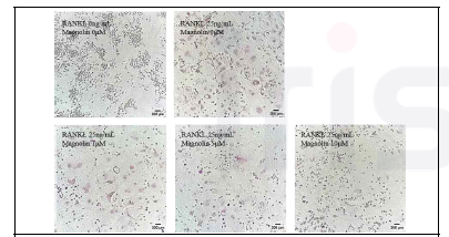 Magnolin의 파골세포 분화 억제 효과
