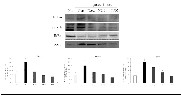 신이 추출물 (ME)의 TLR4-NFκB pathway