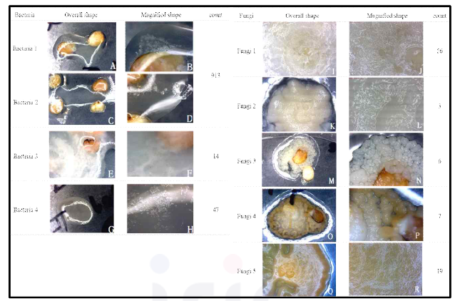 산양삼 종자의 기내배양 과정에서 관찰된 가장 특이적인 세균 4종, 곰팡이 5종의 현미경 관찰 사진