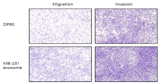 MB-231엑소좀 처리에 의한 migration/ invasion증가