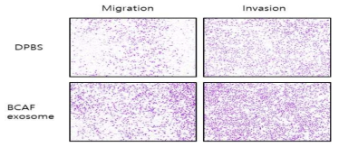 BCAF 엑소좀 처리에 의한 migration/ invasion증가